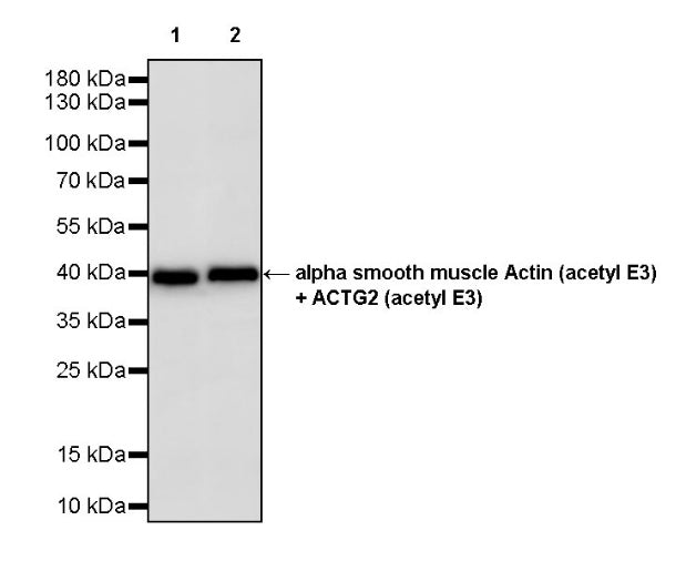 alpha smooth muscle Actin (acetyl E3) + ACTG2 (acetyl E3) Recombiant Rabbit mAb (S-3355)