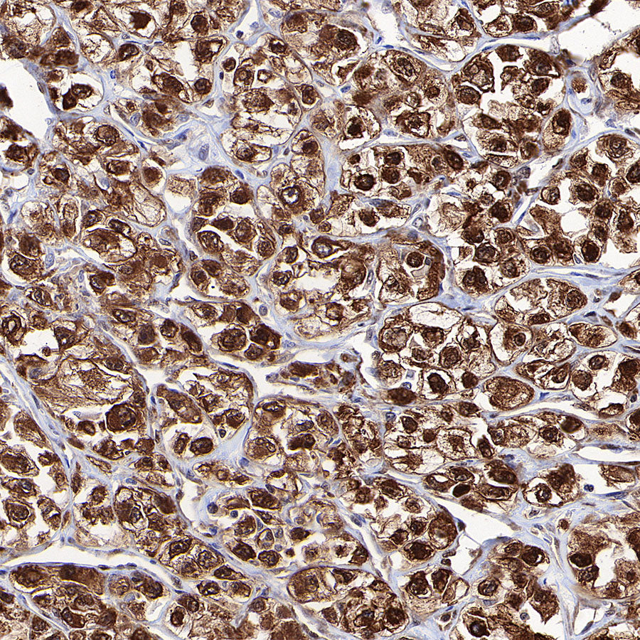 ATP Citrate Lyase Recombinant Rabbit mAb (S-5036)
