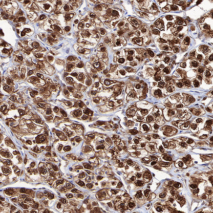ATP Citrate Lyase Recombinant Rabbit mAb (S-5036)