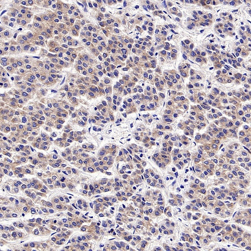 PKA C-α Recombinant Rabbit mAb (S-2564-5)