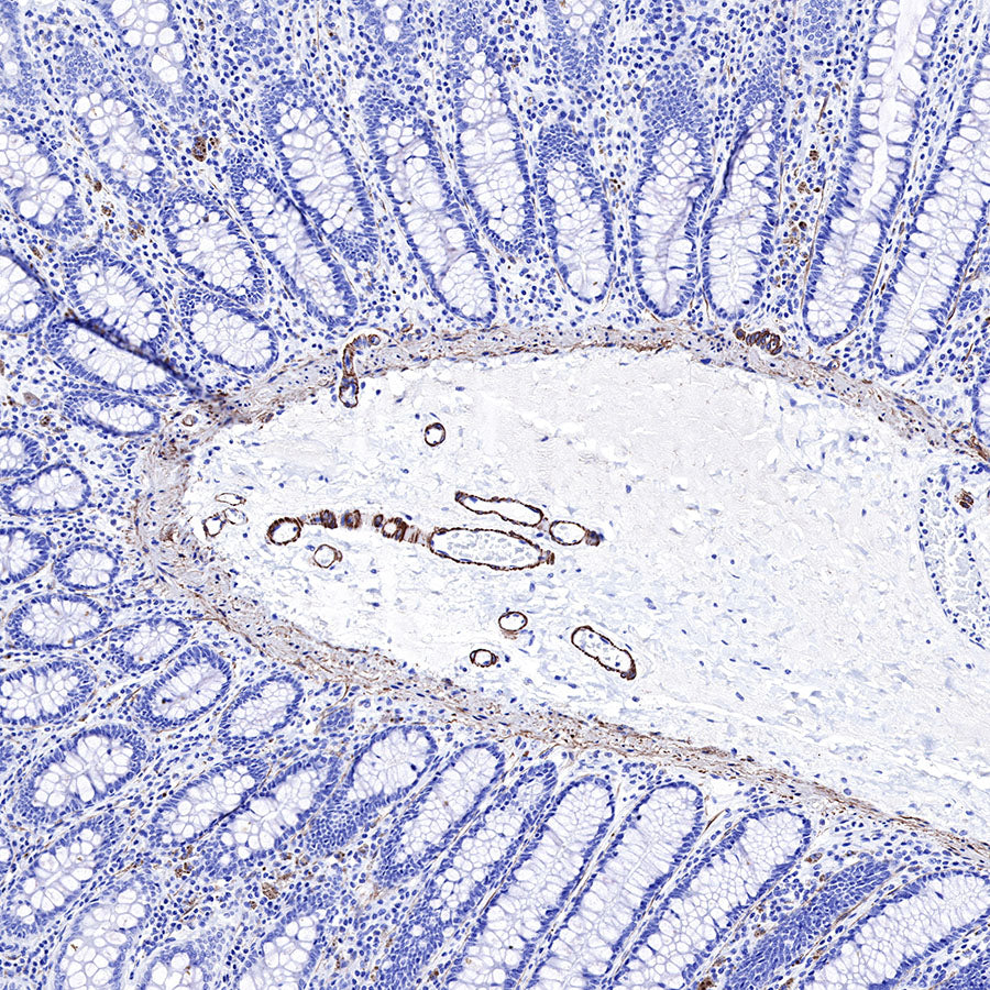 Smooth Muscle Myosin Heavy Chain (SMMHC) Recombinant Rabbit mAb (SDT-R089)