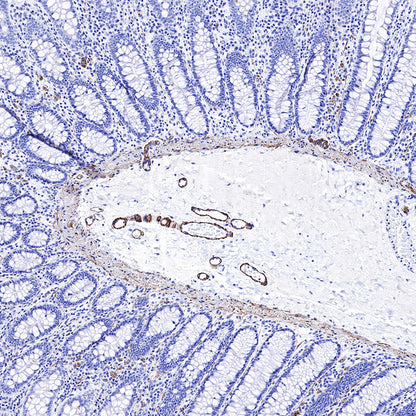 Smooth Muscle Myosin Heavy Chain (SMMHC) Recombinant Rabbit mAb (SDT-R089)