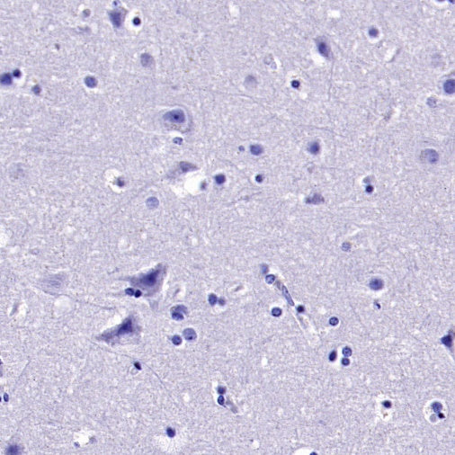 ER alpha Recombinant Rabbit mAb (SDT-2950-36)