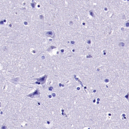 ER alpha Recombinant Rabbit mAb (SDT-2950-36)