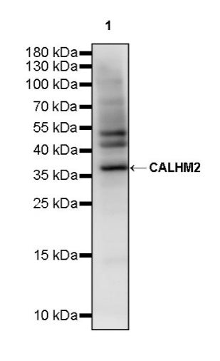 CALHM2 Recombinant Rabbit mAb (S-2671-146)