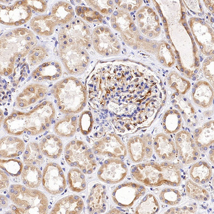 Beta I tubulin Recombinant Rabbit mAb (S-3108-63)