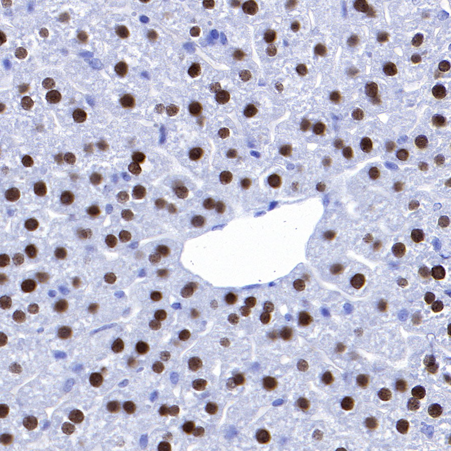 FOXA2 Recombinant Rabbit mAb (SDT-R174)