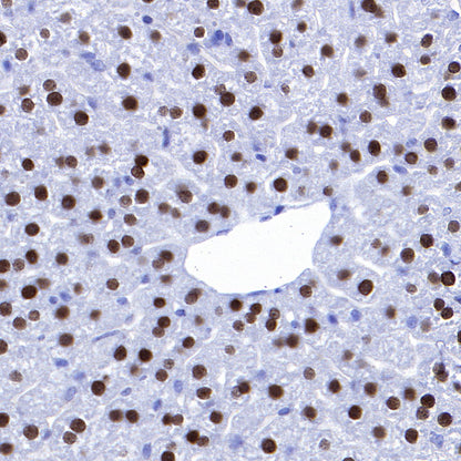 FOXA2 Recombinant Rabbit mAb (SDT-R174)