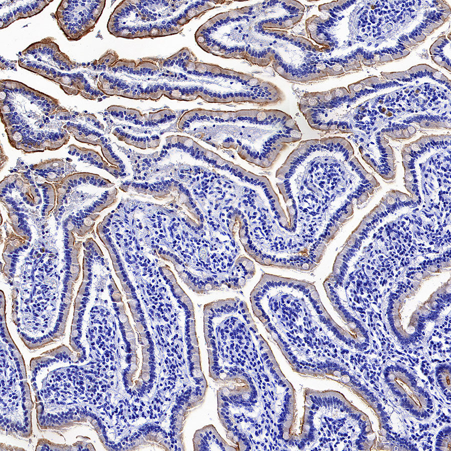 MUC17 Recombinant Rabbit mAb (SDT-3951-56)