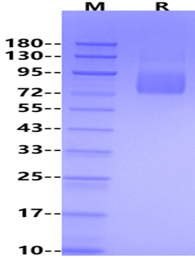 Glycoprotein/GP RBD hFc chimera protein, Ebola virus-Q7T9D9