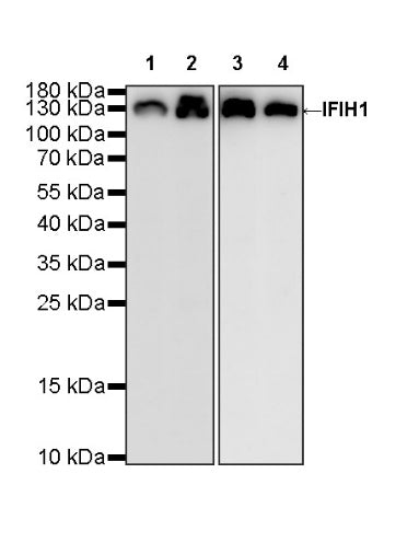 IFIH1 Recombinant Rabbit mAb (S-2413-49)