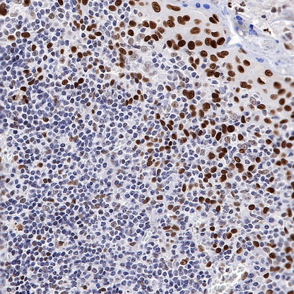 JunB Recombinant Rabbit mAb (S-R294)