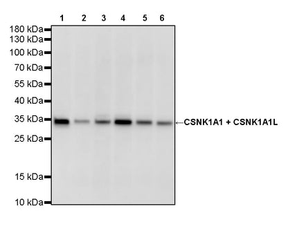 CSNK1A1 + CSNK1A1L Recombinant Rabbit mAb (S-4407-18)