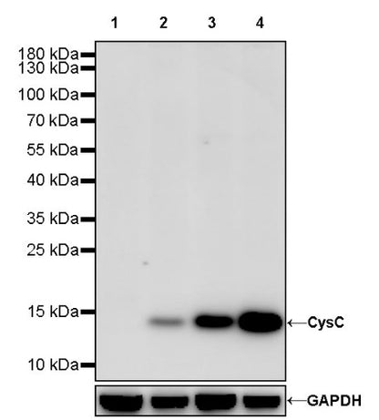 CysC Recombinant Rabbit mAb (S-1658-86)