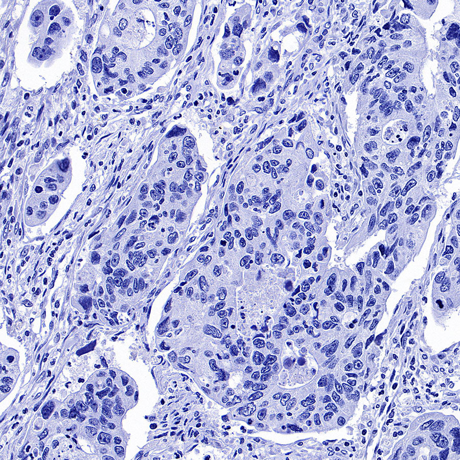 ITPR1 Recombinant Rabbit mAb (S-4530-47)