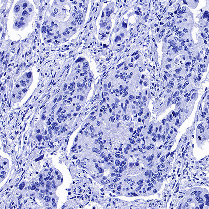 ITPR1 Recombinant Rabbit mAb (S-4530-47)
