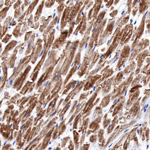 S-RMab® Desmin Recombinant Rabbit mAb (SDT-109-114)