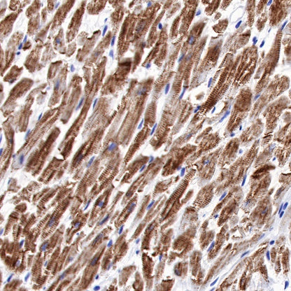 S-RMab® Desmin Recombinant Rabbit mAb (SDT-109-114)