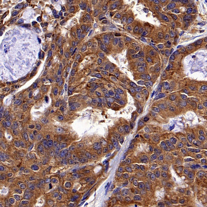 Hexokinase II Rabbit Polyclonal Antibody