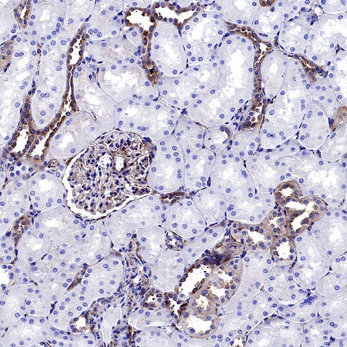 VAMP2 Recombinant Rabbit mAb (S-2359-2)