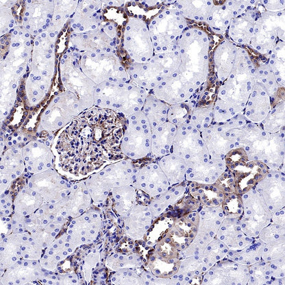 VAMP2 Recombinant Rabbit mAb (S-2359-2)