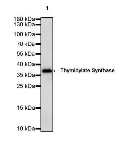 Thymidylate Synthase Recombinant Rabbit mAb (S-753-7)