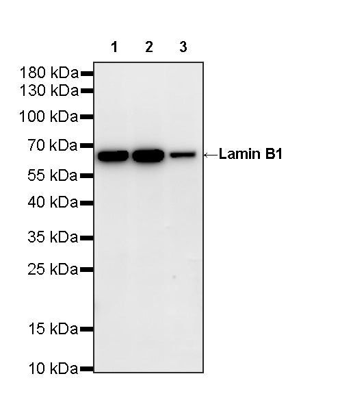 Lamin B1 Recombinant Rabbit mAb (S-5361)