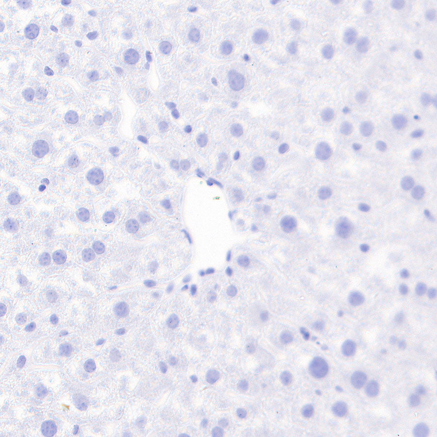 PITX2 Recombinant Rabbit mAb (S-4009-54)