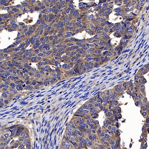 eIF3B Rabbit polyclonal antibody