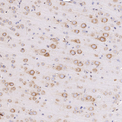 UGGT1 Recombinant Rabbit mAb (S-1079-19)