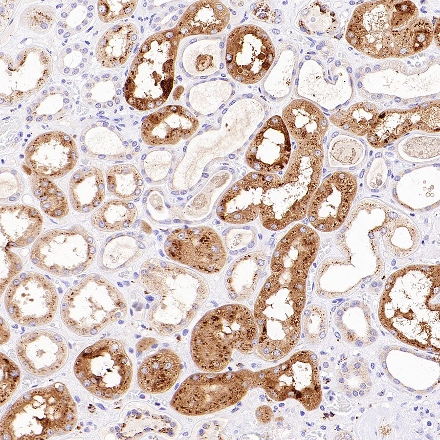 Napsin A Recombinant Mouse mAb,PBS Only (SDT-4204)