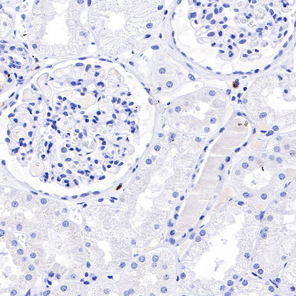 S-RMab® CD20 Recombinant Rabbit mAb,PBS Only (SDT-R133)