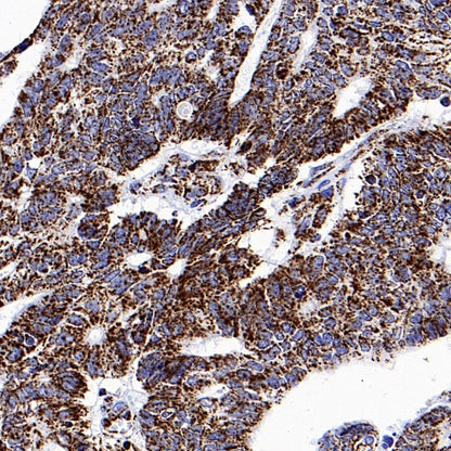 Parkin Rabbit Polyclonal Antibody