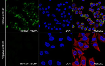 TNFRSF17/BCMA Recombinant Rabbit mAb (S-4674)