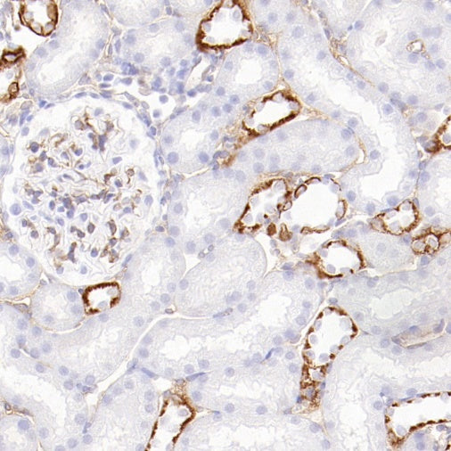 CD105 Recombinant Rabbit mAb (S-3764-11)