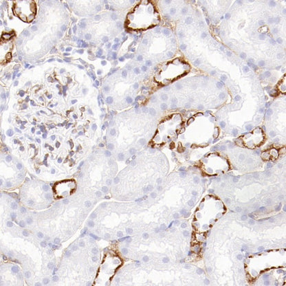 CD105 Recombinant Rabbit mAb (S-3764-11)