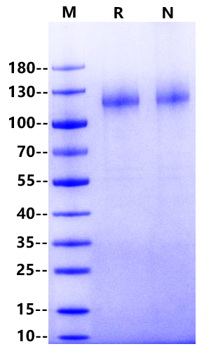 Caprin-1 His Tag Protein, Human/Rhesus macaque/Cynomolgus