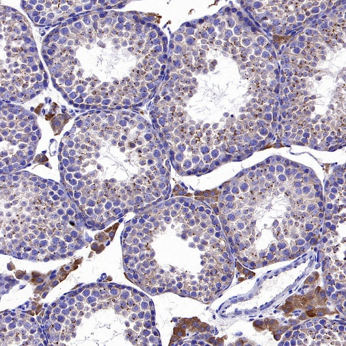 SQLE Recombinant Rabbit mAb (S-2358-207)