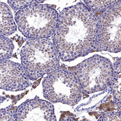 SQLE Recombinant Rabbit mAb (S-2358-207)