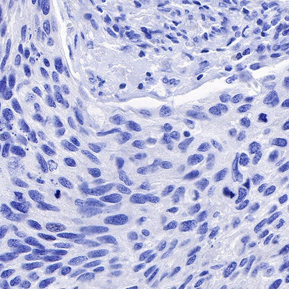 TPO Recombinant Rabbit mAb (SDT-420-57)