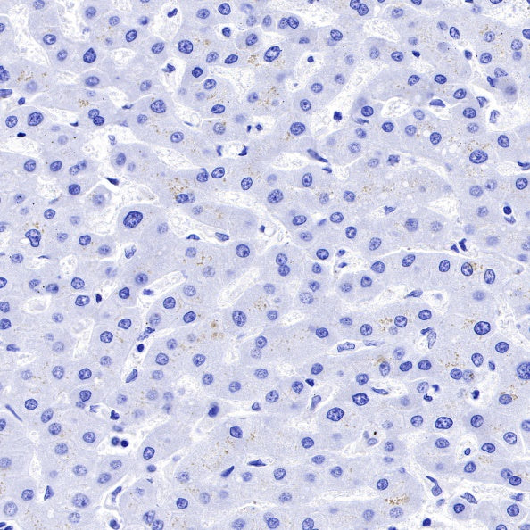 CD19 Recombinant Rabbit mAb (SDT-164-33)