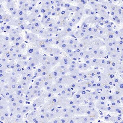 CD19 Recombinant Rabbit mAb (SDT-164-33)