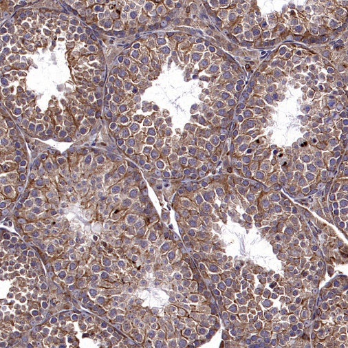 PTP1B Rabbit Polyclonal Antibody