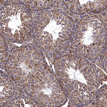 PTP1B Rabbit Polyclonal Antibody