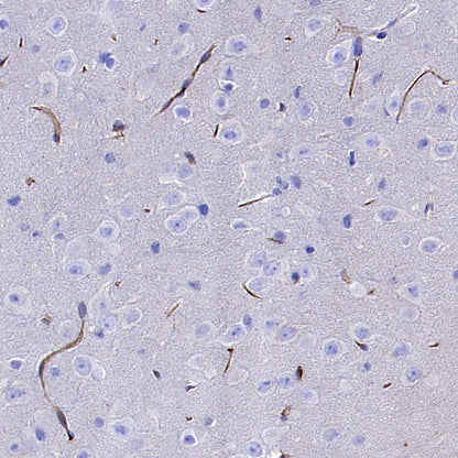Transferrin Receptor Recombinant Rabbit mAb (S-4791)