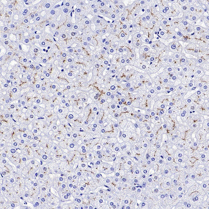 DPP4 Recombinant Rabbit mAb (S-1631-130)