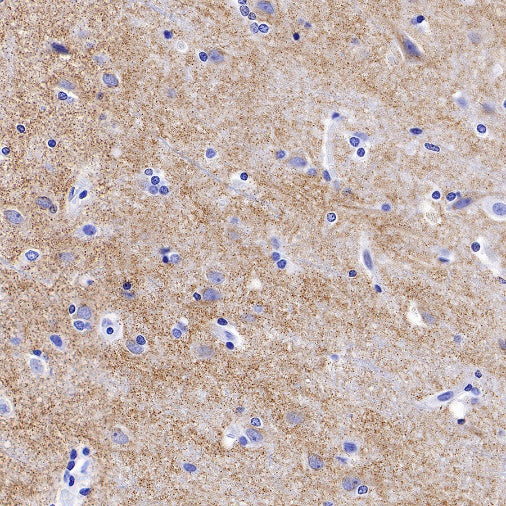 Sarcomeric Alpha Actinin Recombinant Rabbit mAb (S-1652-40)