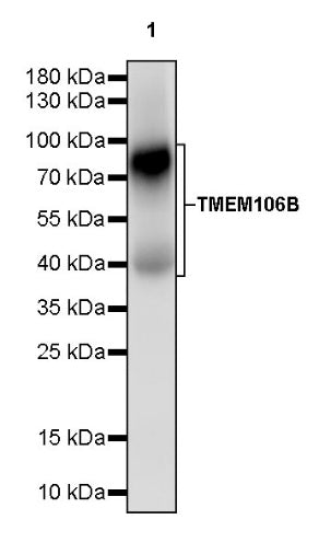 TMEM106B Recombinant Rabbit mAb (S-2362-33)