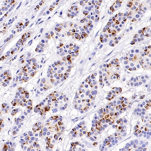 Ganglioside GD2 Recombinant Rabbit mAb (S-R505)