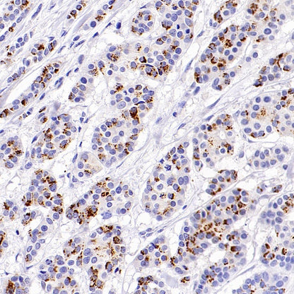 Ganglioside GD2 Recombinant Rabbit mAb (S-R505)